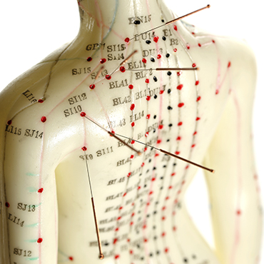 Acupuncture Image - 